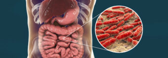 Czy mikrobiota jelitowa i SIBO mogą wpływać na przebieg choroby COVID-19
