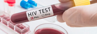 Probówka do badania na HIV